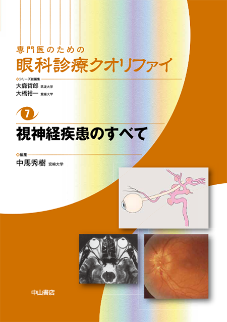 m3電子書籍 | 眼内レンズの使い方〈専門医のための眼科診療