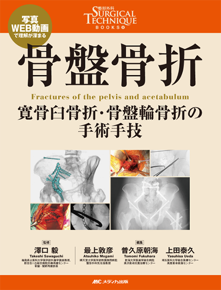 m3電子書籍 | 整形外科SURGICAL TECHNIQUE BOOKS 9 骨盤骨折