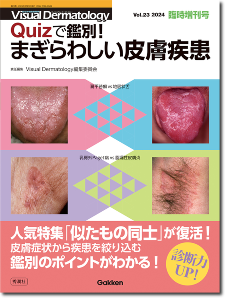 m3電子書籍 | Visual Dermatology 2024年臨時増刊号 Quizで鑑別