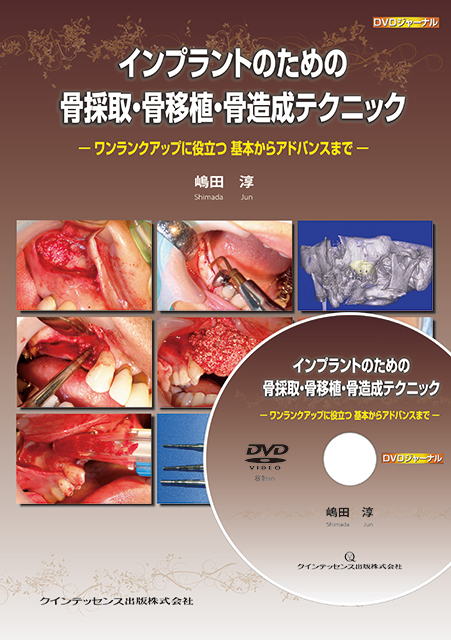 コンセプトをもった予知性の高い歯周外科処置 改訂第2版