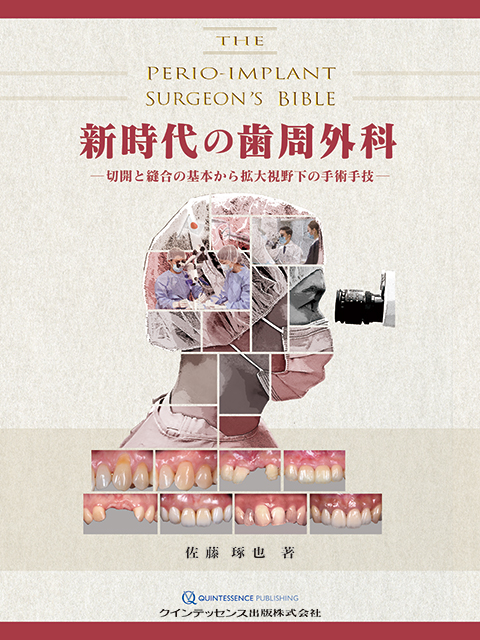 シングル・トゥースインプラント - クインテッセンス出版