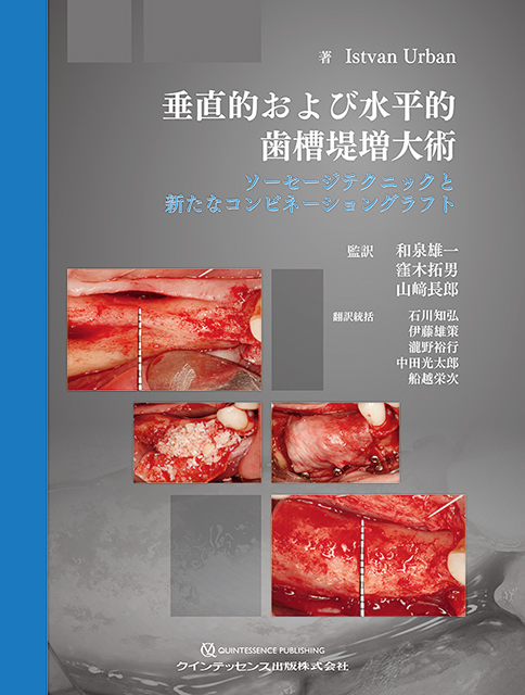 垂直的および水平的歯槽堤増大術 - クインテッセンス出版