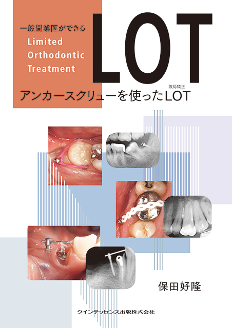 必ず上達 CR（コンポジットレジン）修復 - クインテッセンス出版