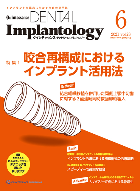 Quintessence DENTAL Implantology 2021年No.6 - クインテッセンス出版