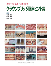 カラーアトラス ハンドブック クラウンブリッジ臨床ヒント集