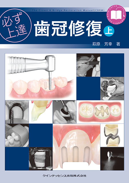 必ず上達 歯冠修復（上） - クインテッセンス出版