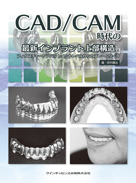 金属焼付ポーセレン下顎前歯部の審美的表現法 - クインテッセンス出版