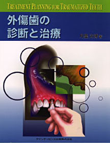 外傷歯の診断と治療 - クインテッセンス出版