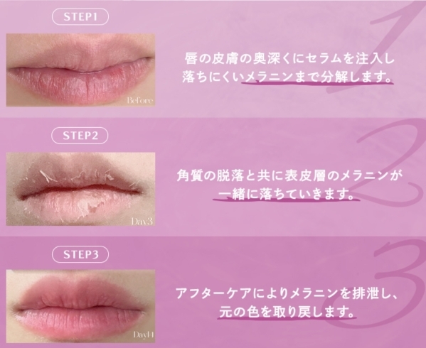 Roma pinkリップで叶える！唇のうるおい・血色感ビフォーアフター紹介