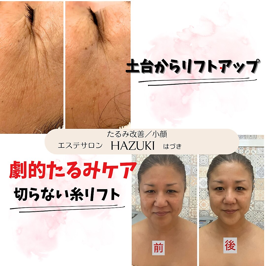 桜木町駅でフェイシャルエステが人気のエステサロン｜ホットペッパー