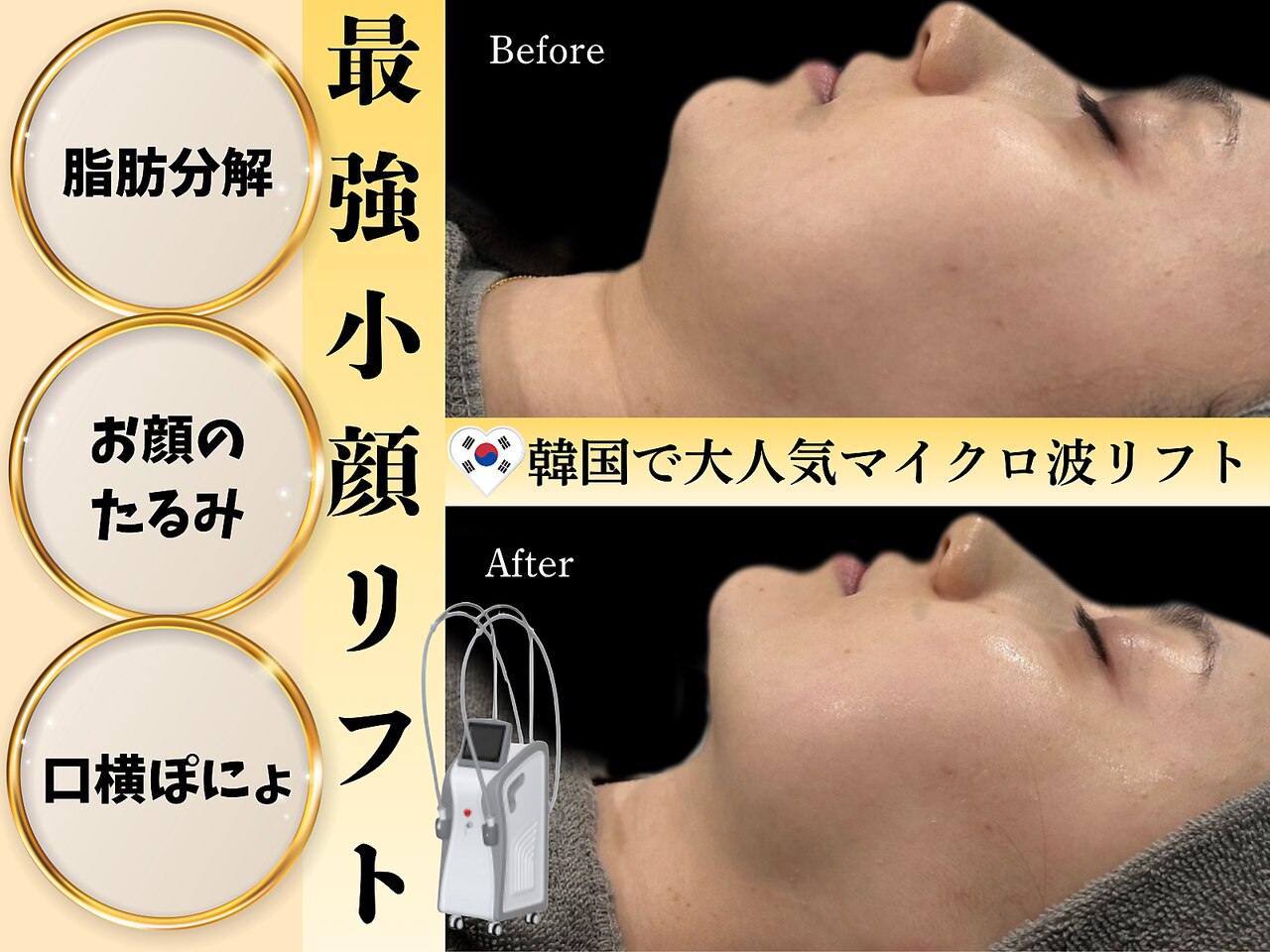 ビズビズ(bizz bizz)｜ホットペッパービューティー