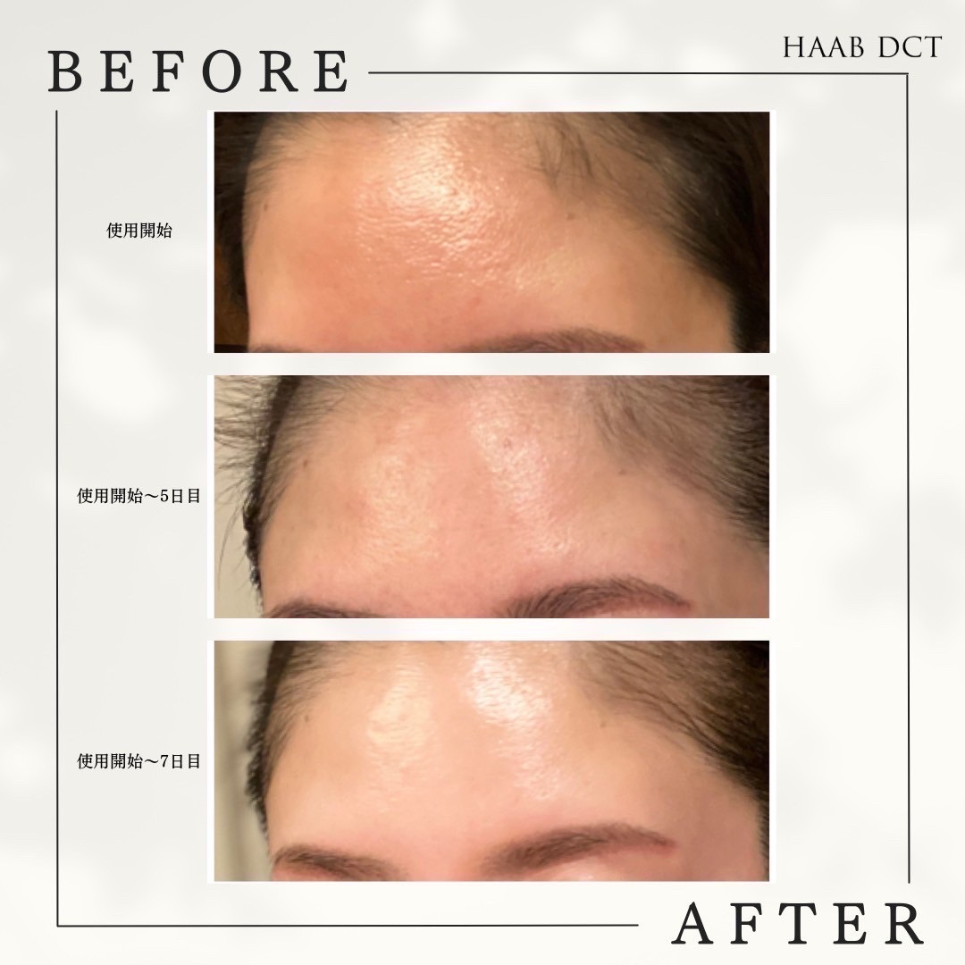 HAAB SKIN プレミアムエクソソーム｜有限会社アイエヌジー