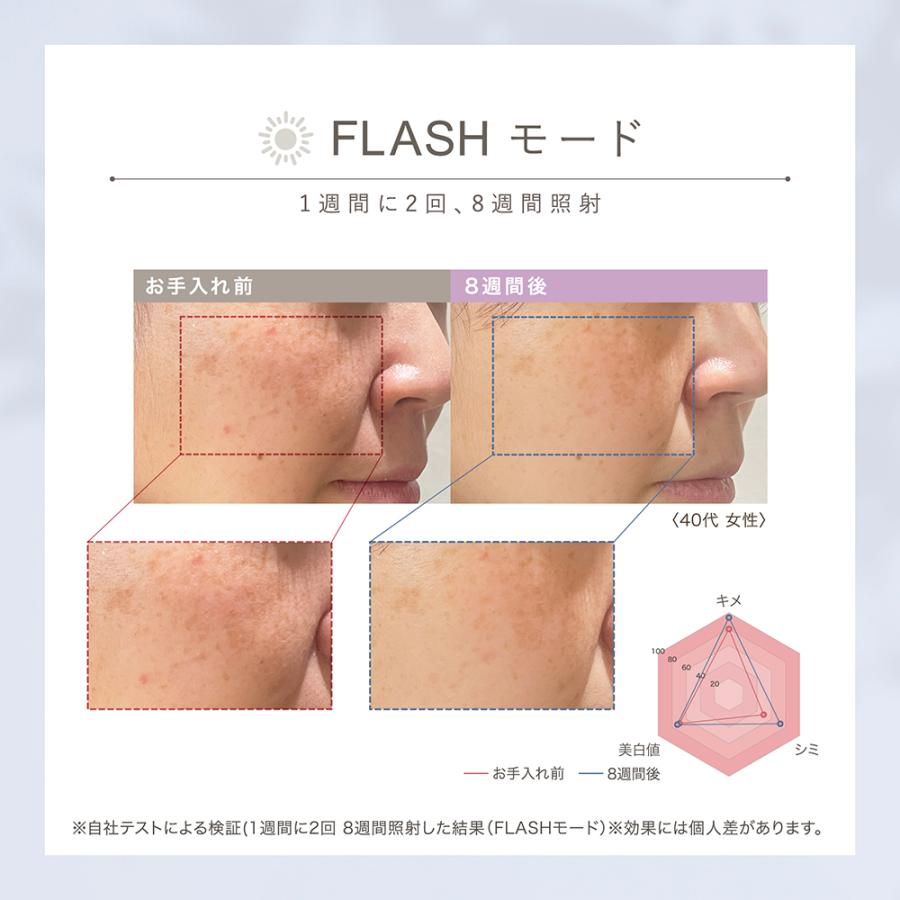 LINKA（リンカ） 美顔器 光美容器 スノー フラッシュ DPL/NIR ブライト