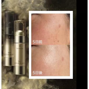 正規品】NARIS ナリス化粧品 新品 セルグレース フォーミュラ(高機能