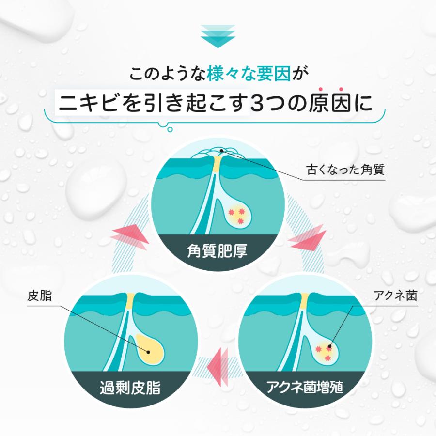 プロアクティブ＋ にきびケア プロアクティブ トライアルキット 30日