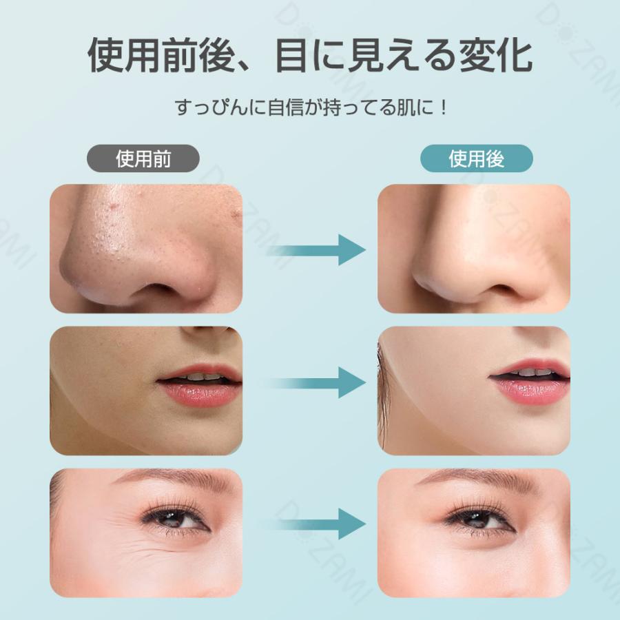 Hokonui 【ホワイトデー人気ギフト】美顔器 超音波美顔器 1台多役