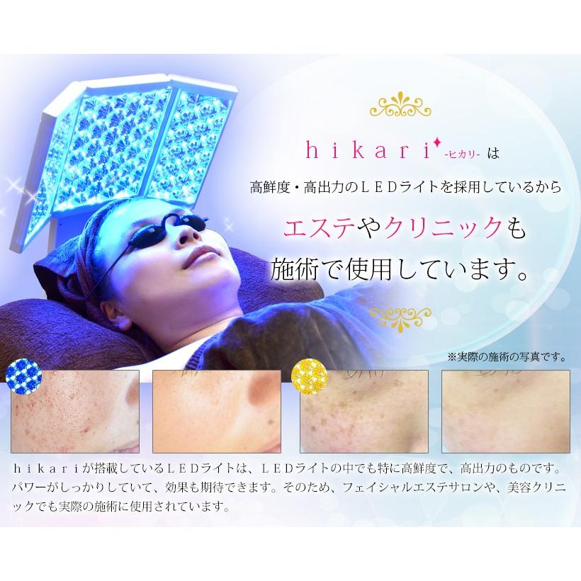 belulu 美顔器 シミ取り トータルケア 光美容器 赤色LED【美ルル