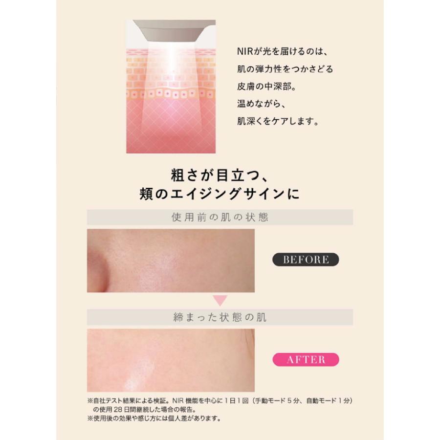 自宅脱毛お試し価格♪】パルス光 IPL美容器 脱毛ケアしやすい