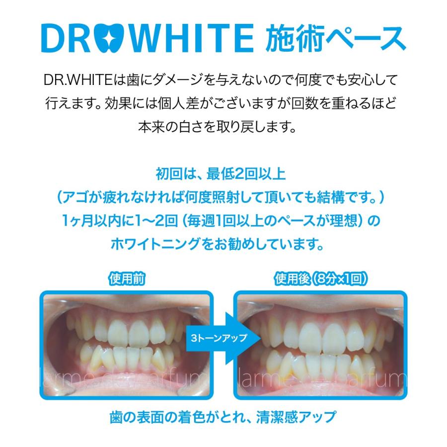 正規品】 ドクターホワイト ホワイトニングキット ジェル4本入り(約15
