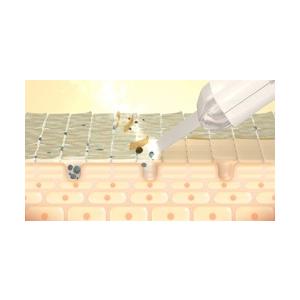 送料無料 CosBeauty 美顔器 アクリアルピーリングプロ ワインレッド CB