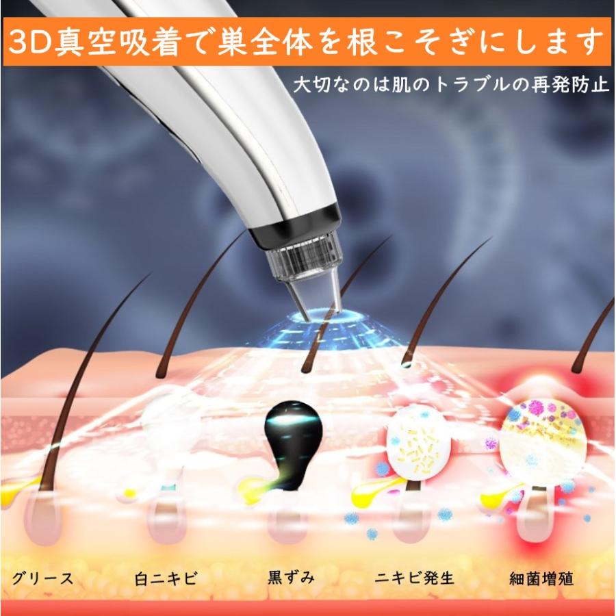 吸引器 ニキビ 毛穴吸引 角質 角栓 ニキビケア 美顔器 5段階吸引力