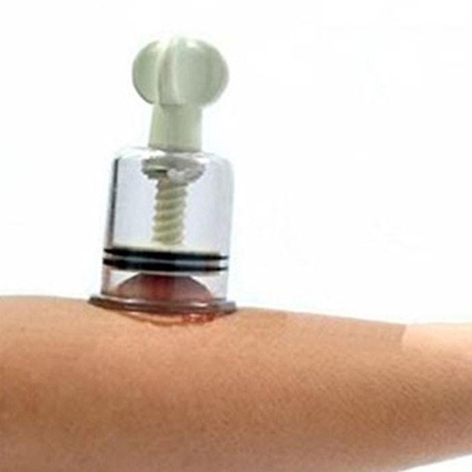 カッピング 真空ツイスト吸引カッピング 吸い玉4点セットねじるタイプ