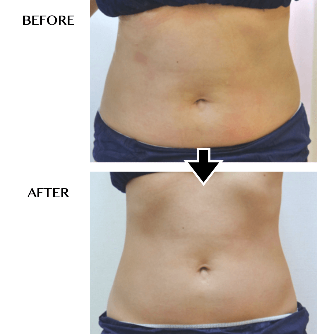 CELLZERO FAST | 「じぶんdeエステ」オンラインショップ【公式】