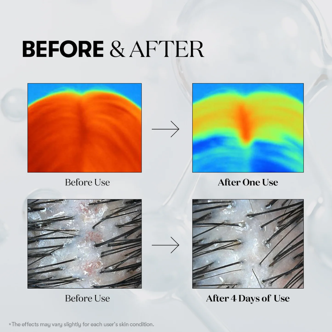 PDRN Reedle Shot Hair Ampoule 700dL – K-Beauty Store