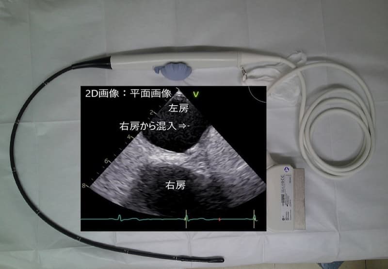 経食道心エコー図検査 | 病院概要 | 沼田脳神経外科循環器科病院