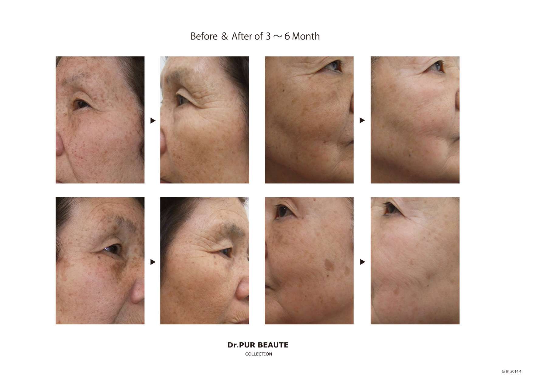 Before・After 特集