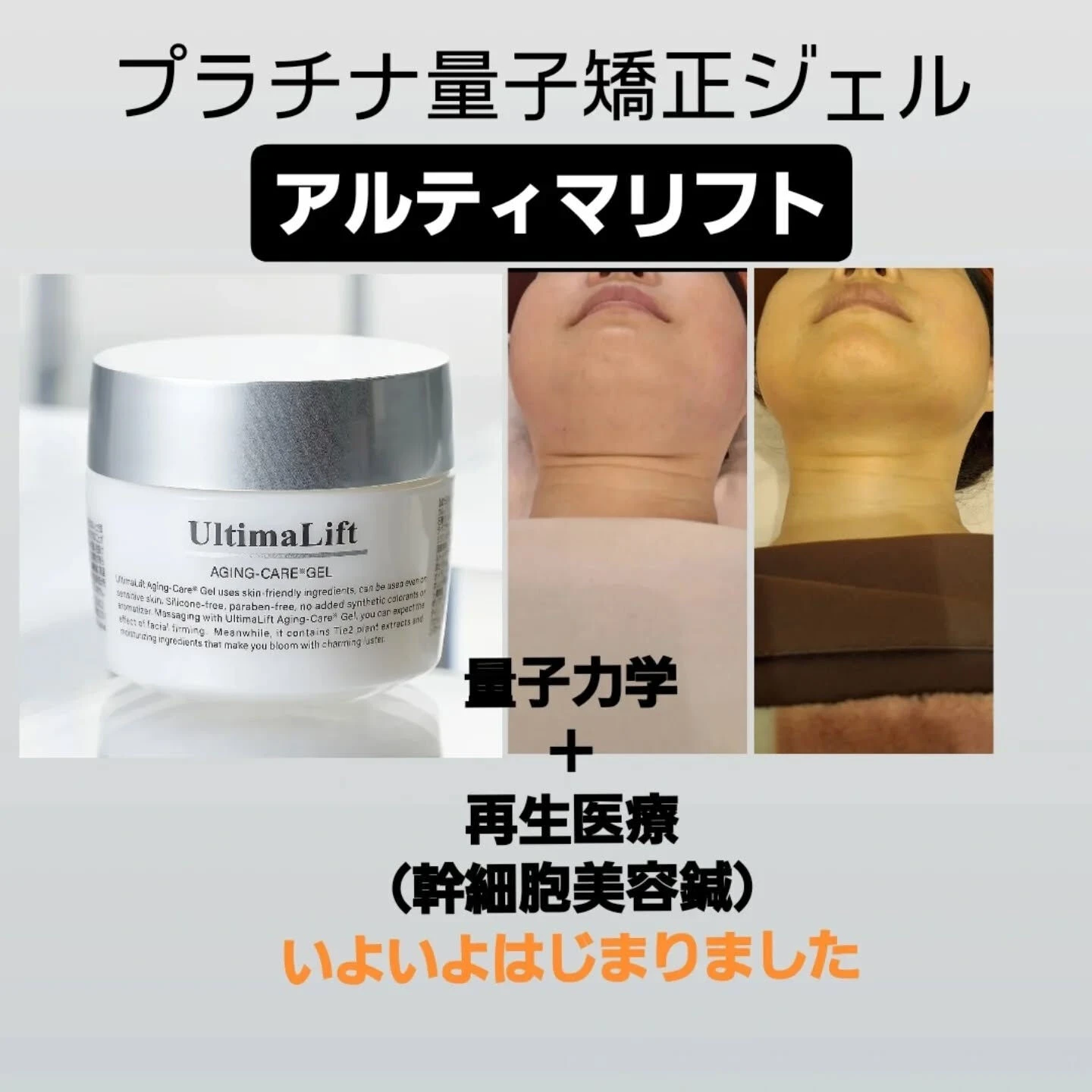 プラチナ量子矯正ジェル（アルティマリフト）の施術への使用、及