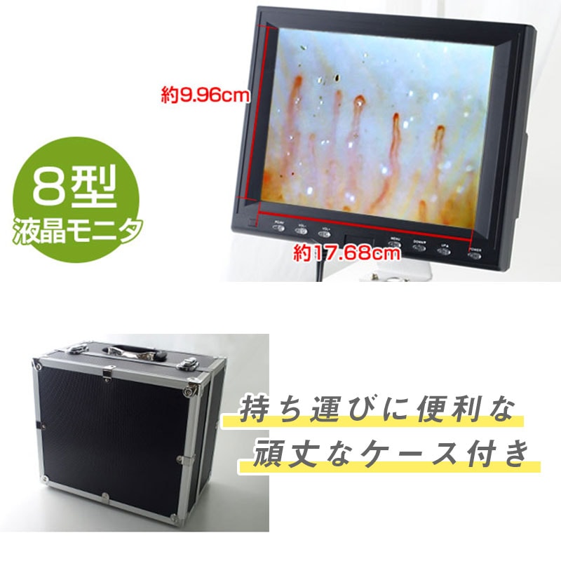 血流スコープサラミール(有線) 3R-MSBTSARAの通販｜美セラ