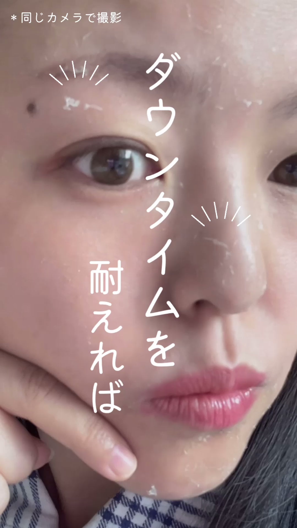 お得な5個セット】プレゼント付き BQCELL(ビーキューセル) ダーマ