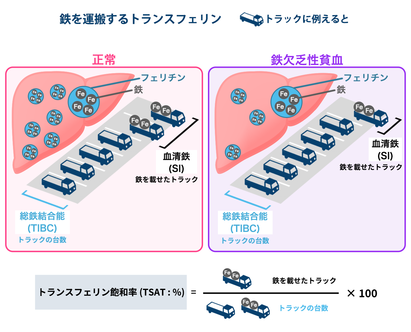 鉄欠乏性貧血の診断と治療｜鉄欠乏性貧血 疾患情報－領域/疾患情報