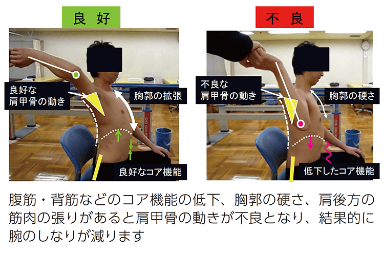 野球肩・野球肘に精通ー適切なコンディション指導や投球動作指導・治療