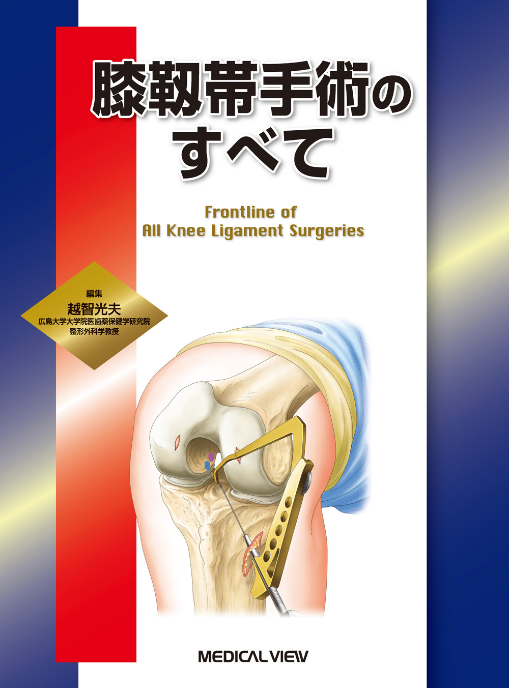 メジカルビュー社｜整形外科｜膝靱帯手術のすべて