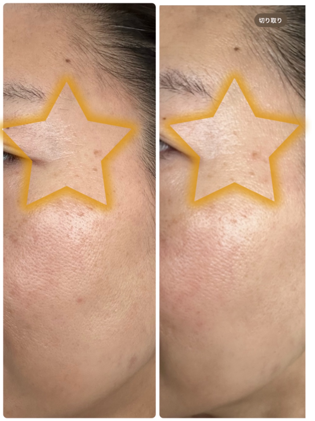 クエスクVA1セラム | スキンケア化粧品・サイエンスコスメのビーグレン