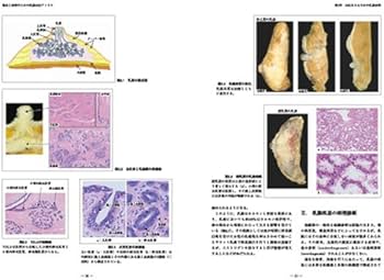 臨床と病理のための乳腺MRIアトラス | 眞一, 土屋, 達夫, 隈崎, 律