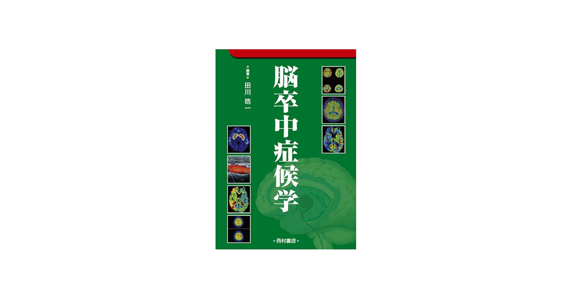 脳卒中症候学 | 田川 皓一 |本 | 通販 | Amazon