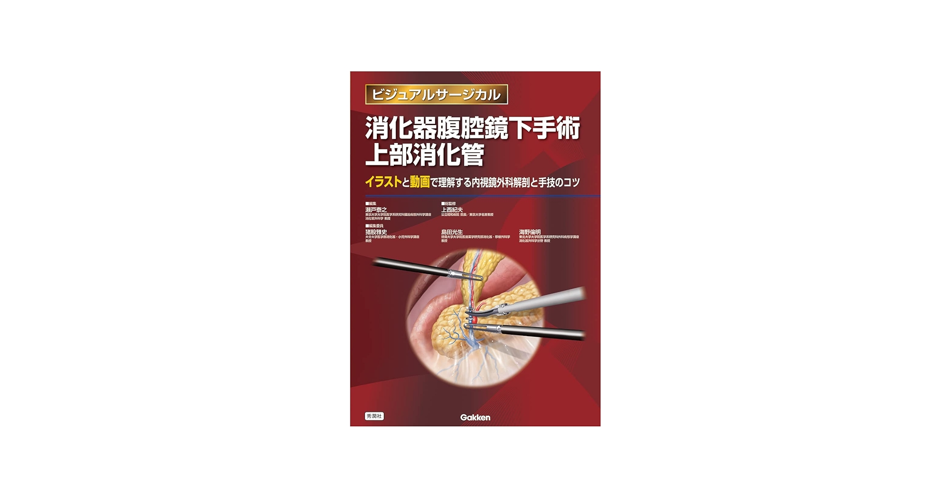 消化器腹腔鏡下手術 上部消化管 (ビジュアルサージカル) | 瀬戸泰之