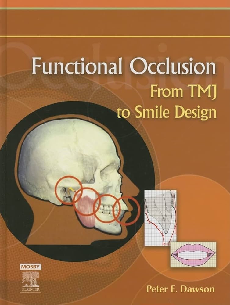 Amazon | Functional Occlusion: From TMJ to Smile Design | Dawson