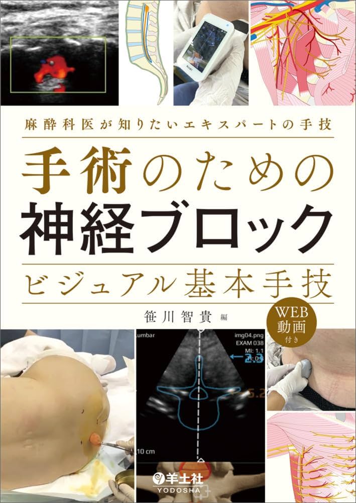 手術のための神経ブロック ビジュアル基本手技〜麻酔科医が知りたい
