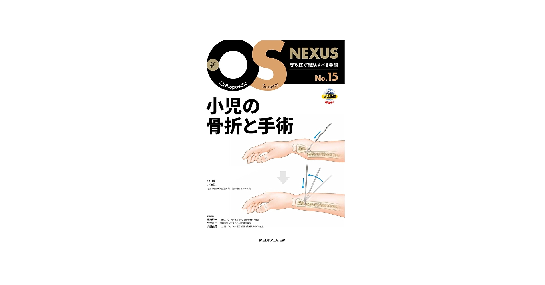小児の骨折と手術［Web動画付］ (新OS NEXUS) | 大谷 卓也 |本 | 通販