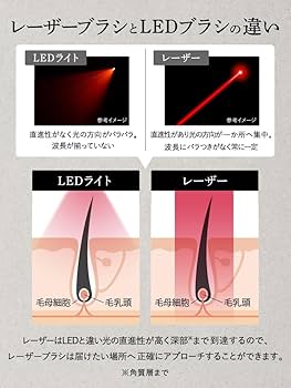 Amazon.co.jp: 【医師推奨】LEXA LXG650｜FDA認証 低出力レーザー LLLT