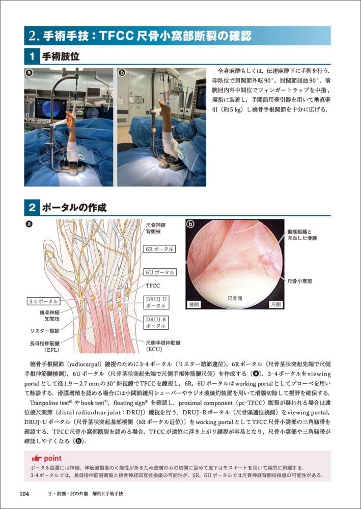 手・前腕・肘の外傷 解剖と手術手技 | 酒井 昭典, 善家 雄吉 |本
