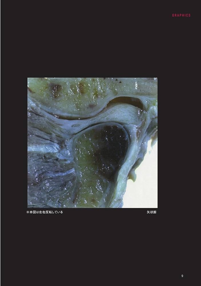 顎関節の画像診断: 臨床医によるMRI・CT読像の手引き | 金田 隆, 箕輪