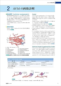 脳動静脈奇形の手術 | 富永 紳介 |本 | 通販 | Amazon