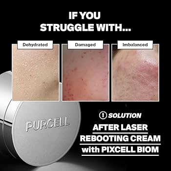 Amazon.com: PURCELL PIXCELL BIOM™ After Laser Rebooting Cream for