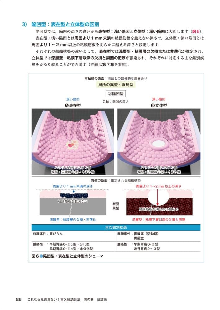 これなら見逃さない！胃X線読影法 虎の巻 改訂版〜シェーマ＋内視鏡像