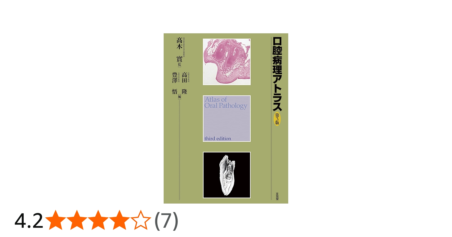 口腔病理アトラス | 高木 實, 高田 隆, 豊澤 悟 |本 | 通販 | Amazon